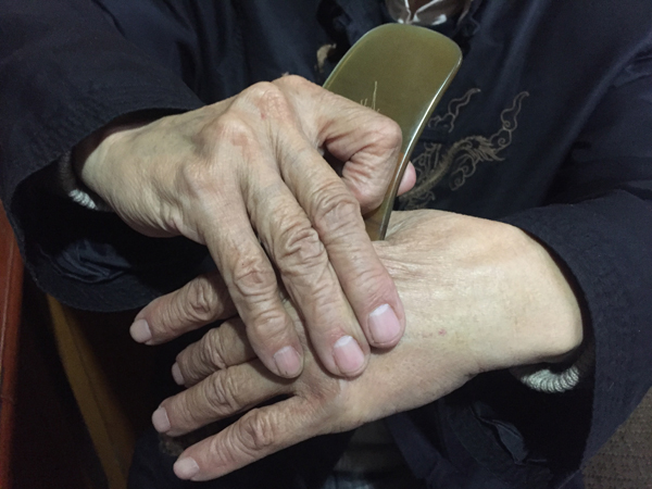 就算没有神针赵天才还有痧痴李湘授